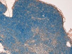 STAT3 Antibody, Novus Biologicals 0.1mg; Unlabeled:Antibodies, Polyclonal